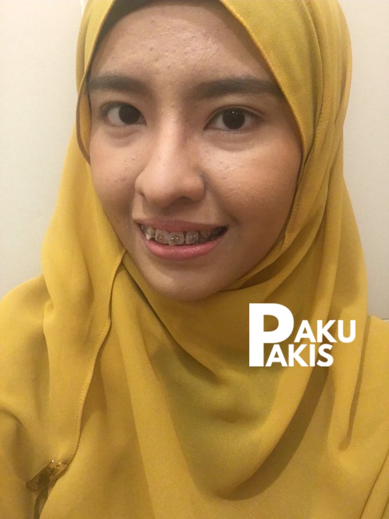 Farah Nabilah 1